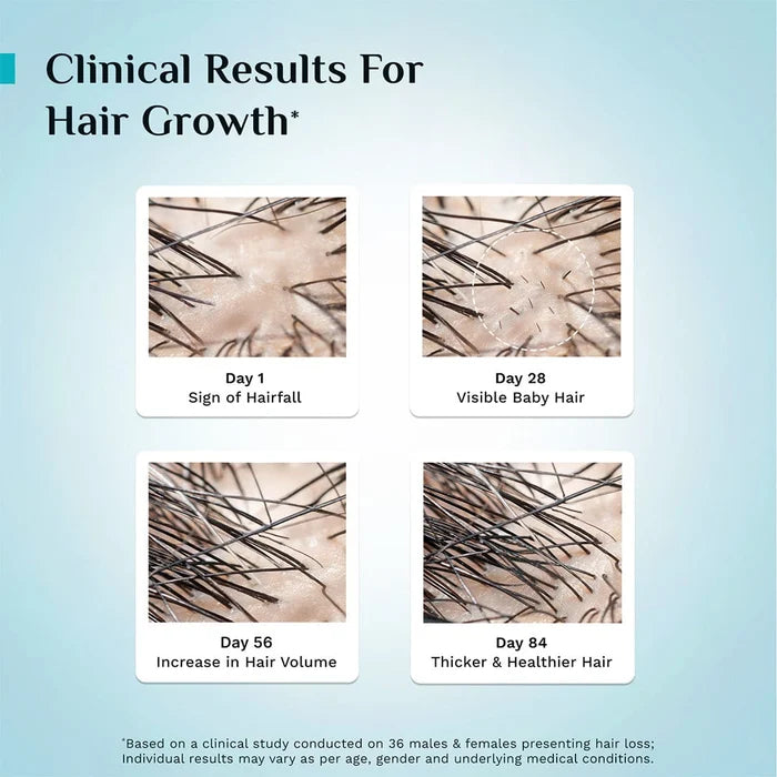 3% Redensyl & 4% Anagain Advanced Hair Growth Serum 100 ml