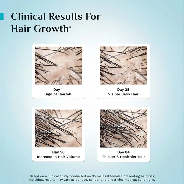 3% Redensyl, 4% Anagain & 5% Capilia Stem Cell Complex Advanced Hair Growth Serum